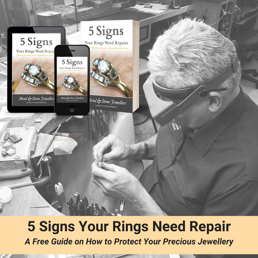 5 Signs Your Rings Need Repairs
